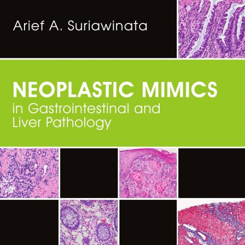 Neoplastic Mimics in Gastrointestinal and Liver Pathology