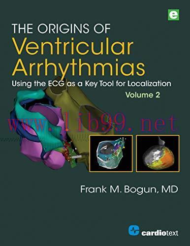 [AME]The Origins of Ventricular Arrhythmias: Using the ECG as a Key Tool for Localization, Volu...