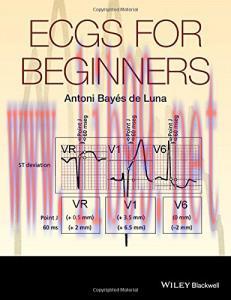 [AME]ECGs for Beginners