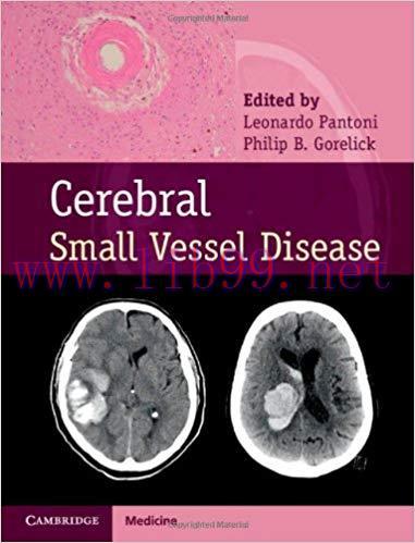 [PDF]Cerebral Small Vessel Disease