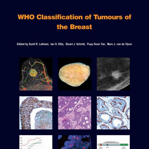 WHO Classification of Tumours of the Breast 4th - Wei Zhi