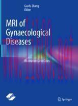 [PDF]MRI of Gynaecological Diseases: Illustrations and Cases