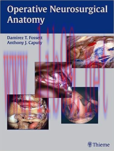 [PDF]Operative Neurosurgical Anatomy