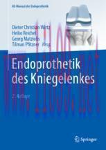 [PDF]Endoprothetik des Kniegelenkes