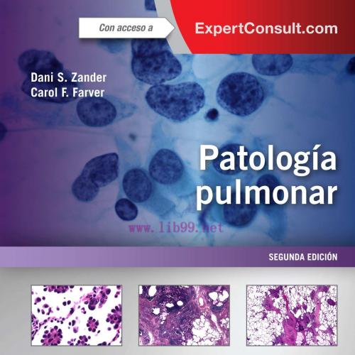 [AME]Patolog&iacute;a pulmonar + ExpertConsult (Spanish Edition) (PDF)