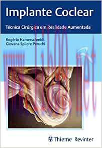 [AME]Implante Coclear: T&eacute;cnicas Cir&uacute;rgica em Realidade Aumentada (Original PDF)