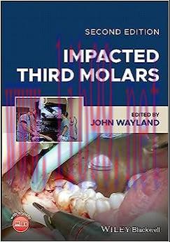 [AME]Impacted Third Molars, 2nd Edition (EPUB)