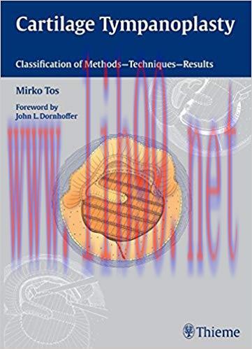 [PDF]Cartilage Tympanoplasty - Classification of Methods Techniques Results