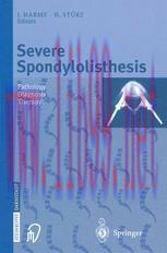 [PDF]Severe Spondylolisthesis: Pathology - Diagnosis - Therapy