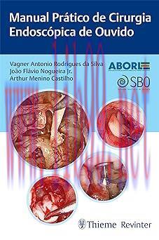 [AME]Manual Pr&aacute;tico de Cirurgia Endosc&oacute;pica de Ouvido (Portuguese Edition) (EPUB)