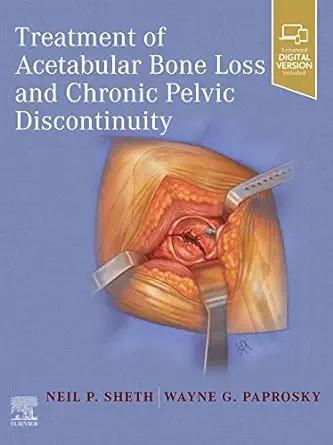 [AME]Treatment of Acetabular Bone Loss and Chronic Pelvic Discontinuity (EPUB)