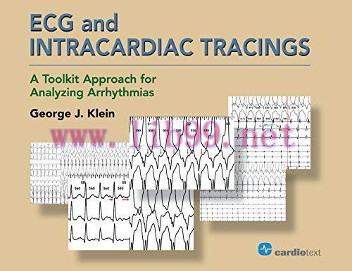 [AME]ECG and Intracardiac Tracings: A Toolkit Approach for Analyzing Arrhythmias (HQ PDF)