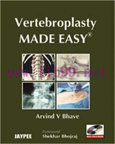 [PDF]Vertebroplasty Made Easy