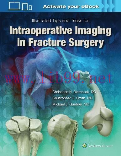 [AME]Illustrated Tips and Tricks for Intraoperative Imaging in Fracture Surgery (EPUB)