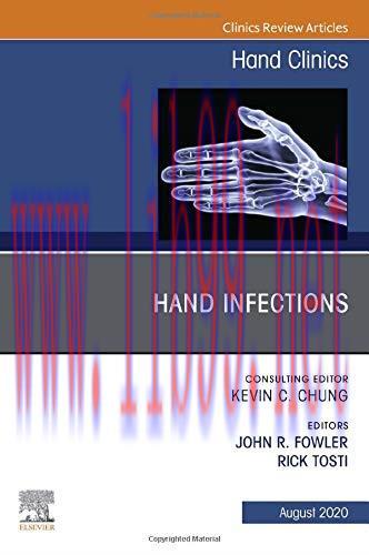 [AME]Hand Infections, An Issue of Hand Clinics (Volume 36-3) (The Clinics: Orthopedics, Volume ...