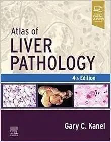 [AME]Atlas of Liver Pathology, 4th Edition (True PDF from_ Publisher)