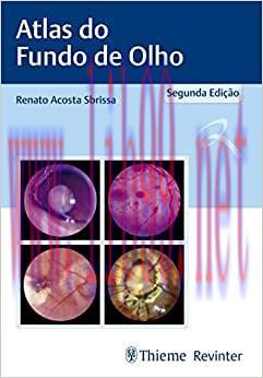 [AME]Atlas do Fundo de Olho, 2nd Edition (Original PDF)