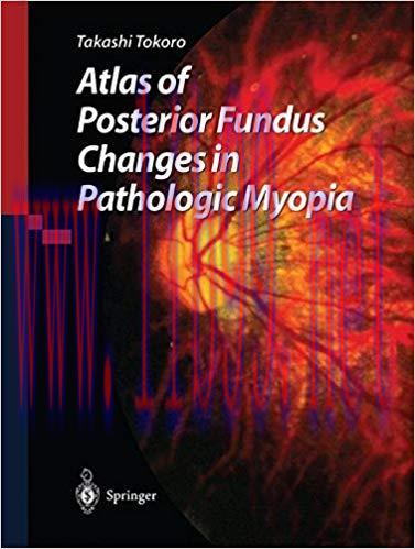 [PDF]Atlas of Posterior Fundus Changes in Pathologic Myopia + EPUB