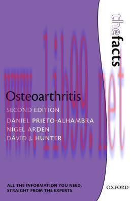 [AME]Osteoarthritis: The Facts