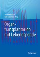 [PDF]Organtransplantation mit Lebendspende