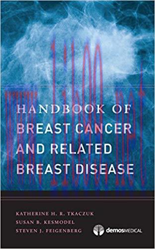 [PDF]Handbook of Breast Cancer and Related Breast Disease