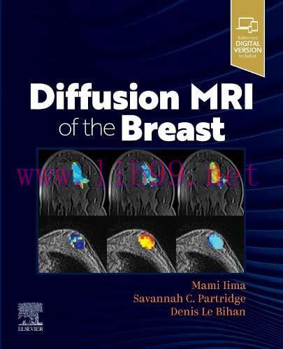 [AME]Diffusion MRI of the Breast (Original PDF)