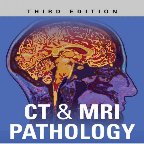 CT & MRI Pathology_ A Pocket Atlas, 3rd Third Edition - Michael L Grey & Jagan Mohan Ailinani
