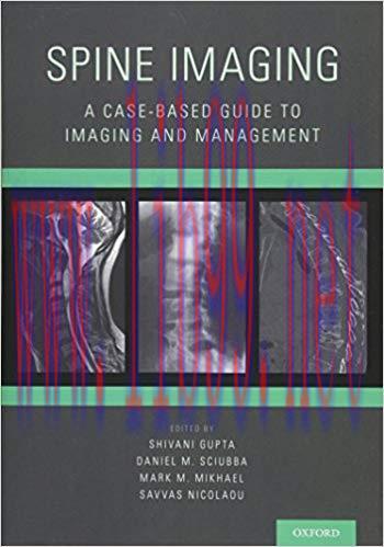 [PDF]Spine Imaging: A Case-Based Guide to Imaging and Management