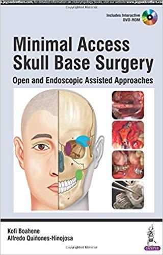 Minimal Access Skull Base Surgery - Open and Endoscopic Assisted Approaches