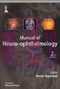 [AME]Manual of Neuro-ophthalmology, 2nd Edition