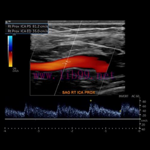 [AME]Society for Vascular Medicine Comprehensive Review of Vascular Ultrasound Interpretation a...