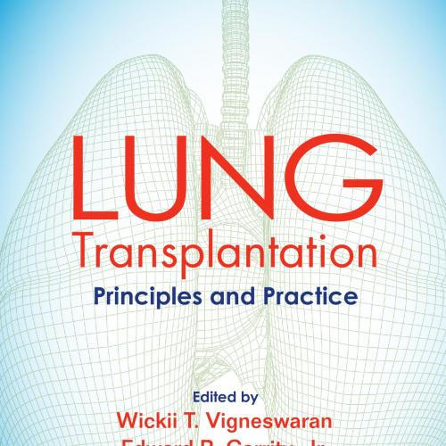 Lung Transplantation Principles and Practice