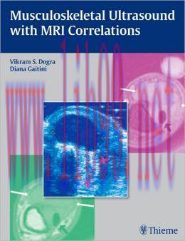 [AME]Musculoskeletal Ultrasound with MRI Correlations (ORIGINAL PDF from_ Publisher)