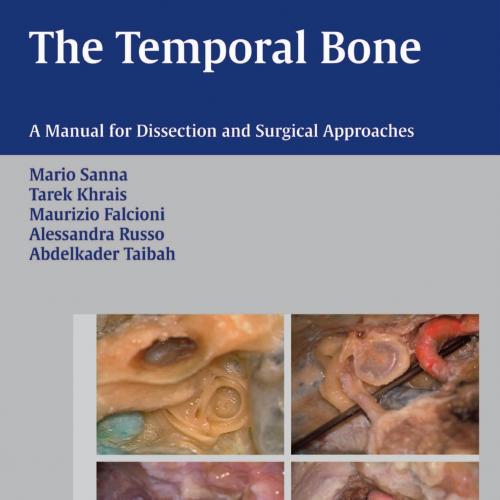 Temporal Bone _ A Manual for Dissection and Surgical Approaches - Sanna, M_