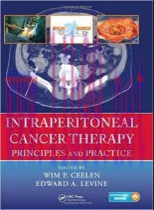 [AME]Intraperitoneal Cancer Therapy: Principles and Practice