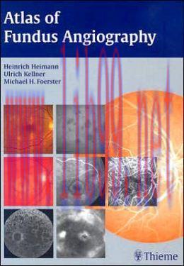 [AME]Atlas of Fundus Angiography