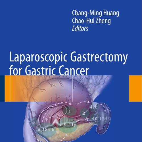 Laparoscopic Gastrectomy for Gastric Cancer Surgical Technique and Lymphadenectomy-Wei Zhi