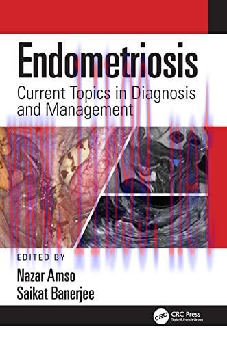 [AME]Endometriosis: Current Topics in Diagnosis and Management (EPUB)