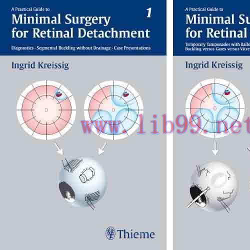 [PDF]A Practical Guide to Minimal Surgery for Retinal Detachment, Volume I and 2