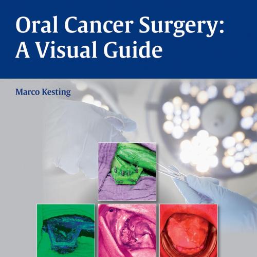 Oral Cancer Surgery A Visual Guide, 1E (2015)