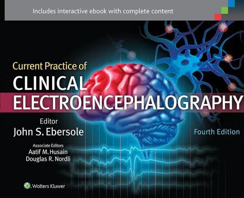 Current Practice of Clinical Electroencephalography 4th Edition