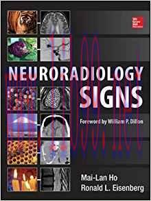 [PDF]Neuroradiology Signs