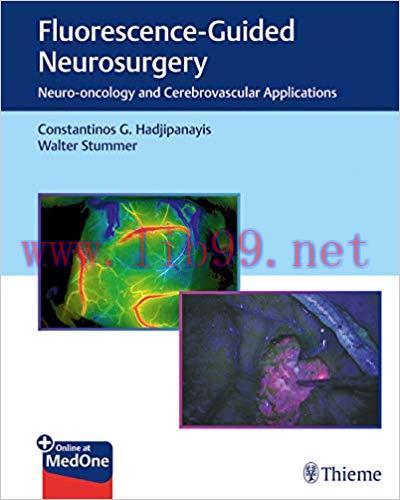 [PDF]Fluorescence-Guided Neurosurgery: Neuro-oncology and Cerebrovascular Applications
