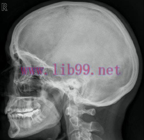 [AME]A teaching file of X rays and scans (EPUB)