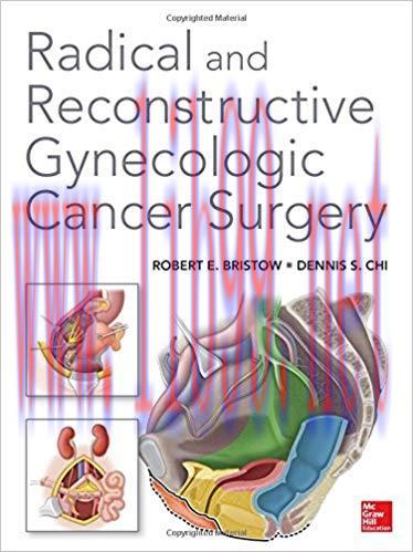 [PDF]Radical and Reconstructive Gynecologic Cancer Surgery