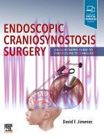 [PDF]Endoscopic Craniosynostosis Surgery