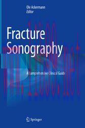 [AME]Fracture Sonography (Original PDF)