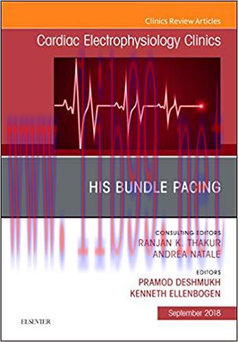 [PDF]His Bundle Pacing