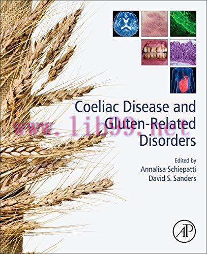 [AME]Coeliac Disease and Gluten-Related Disorders (Original PDF)