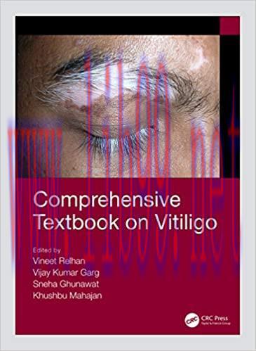 [AME]Comprehensive Textbook on Vitiligo (Original PDF From_ Publisher)